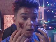 Will's skin being opened up by the Advent Calendar's abilities.