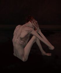 A docile SCP-096 sitting with it's hands over it's ears.