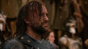 The Hound GoT