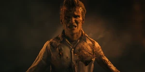 One, burned and disfigured.