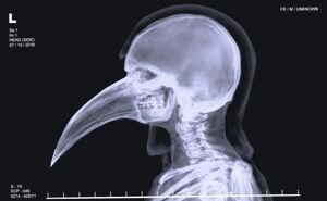 X-ray image of SCP-049's skull.