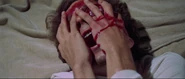 George Barnet Gouged.jpg (320 KB) Barnet after his eye was mutilated