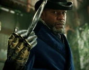 Nathaniel's prosthetic hand.