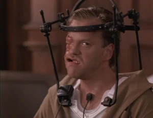 Bob left hideously disfigured after being shot multiple times.