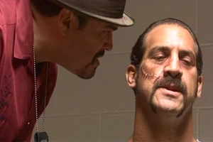 Little Chino scar.jpg (90 KB) Little Chino with the scar Dexter gave him.