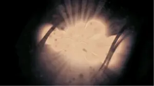 Lo Splendore rilascia l'Infezione da dentro il Cavaliere Vacuo.