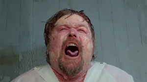 Artie Swelling in Critical Pain.