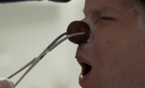 Meg rips Kent's clown nose off