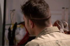 Yates' surgery scar.