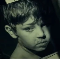 A photo of a young Arthur Fleck covered with markings and bruises, as a result of the abuse inflicted on him in the past.