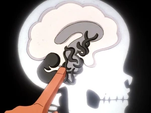 An x-ray of an alien spore that comes from Unity.