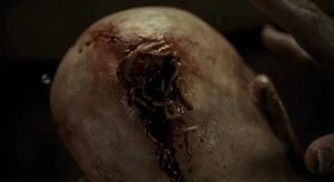 Jacob Goodnight 8.jpg (79 KB) The maggot-infested hole in the back of Jacob Goodnight's head.