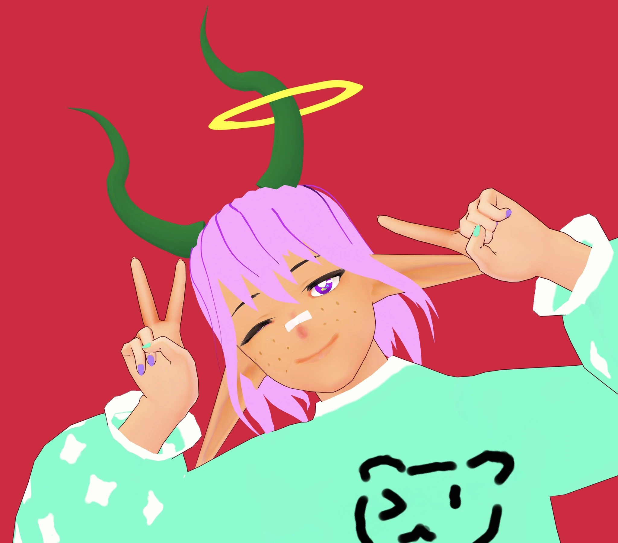 Roen's model<br>(by himself)
