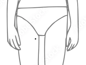 Thigh Mole