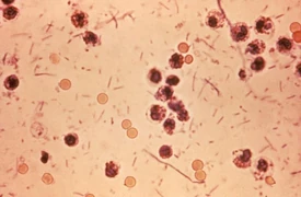 Shigella stool