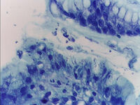 Stomach helicobacter giemsa