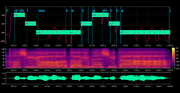 VOCALOID AI Synthesis