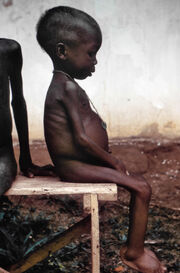 Starved girl