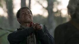 11x21 Wilson Bleeding