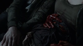 11x07 Mother's Bites