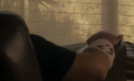 SC thomas' bitten arm