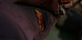 FTWD 8x05 Grace's Bite