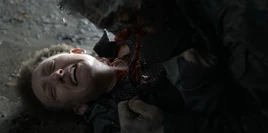 FTWD 8x06 Sam's Bite