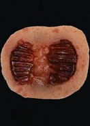 Walker Large Bites Appliance[27]