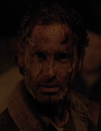 516 Rick Bloodied