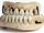 Lisa del Giocondo's Teeth