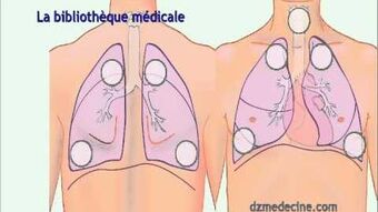 Auscultation poumons