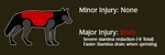 WQ-AE packinfo injury-major body.png (106 KB) Image