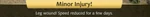 WQ-AE notifications injuries-minor leg-wound.png (83 KB) Minor injury: Leg wound