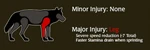 WQ-AE packinfo injury-major leg.png (103 KB) Image