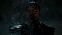Lady Amalisa's burned face