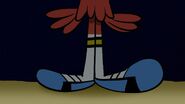 S1e2b Wander's foot bulging