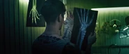 Zero Hero looking at an x-ray scan of his broken wrist