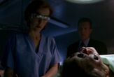 Scully points out someone reached into Delario's head like it was a bowling ball.