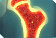 Adaptive Bone Marrow