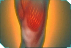 Boosted Muscle Fiber