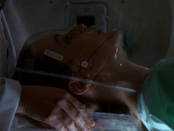 Dana Scully traitements cancer journal de mort.png