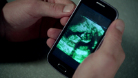 5x03 Sonogram