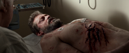 Logan's Wounds (LOGAN)