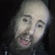 His teeth are horribly decayed