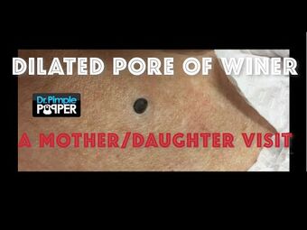 Dr. Sandra Lee aka Dr. Pimple Popper Wikitubia Fandom
