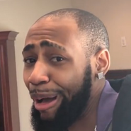 Daequan's 'hairline' meme after his 1 million subscriber hair reveal.