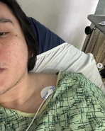 In the hospital for appendicitis