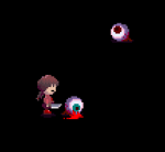An eyeball, hurt by the Knife